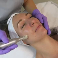 Vanity Spa Micro-Needling Sonja